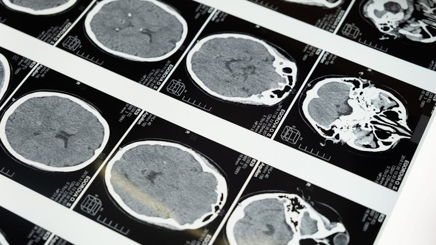cerveau