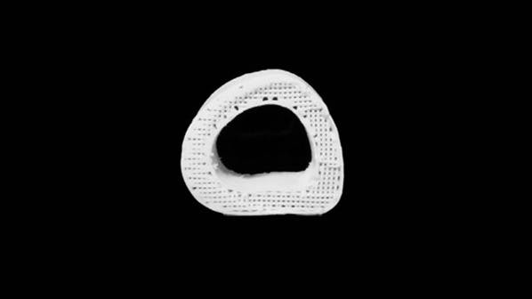 Imprimé en 3D, cet os synthétique permettra bientôt de réparer les fractures à moindre coût