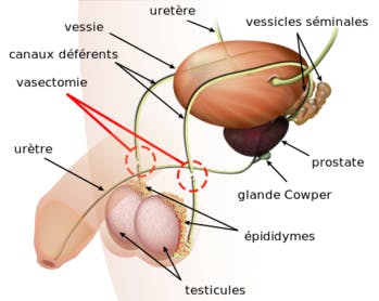 En attendant la pilule pour homme, connaissez-vous ces méthodes de contraception masculine?