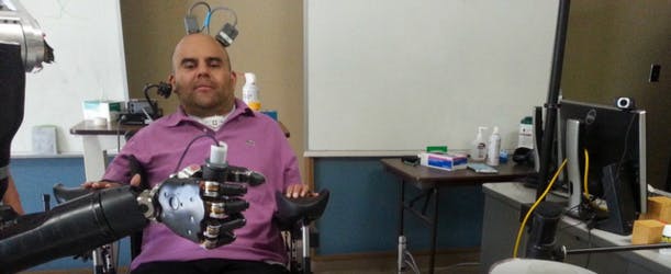 Un tétraplégique contrôle un bras artificiel par la pensée
