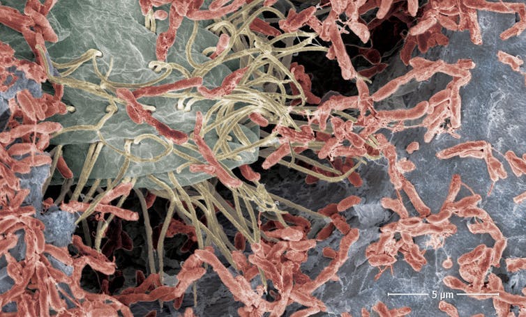 microscopie de bactéries sur une électrode conductrice