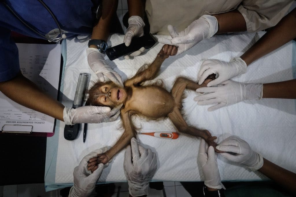 Une jeune femelle orang outan de trois mois est en train d'être traitée par les vétérinaires du centre spécialisé de Sibolangit sur l'île de Sumatra en Indonésie. Photo : Alain Schroeder.