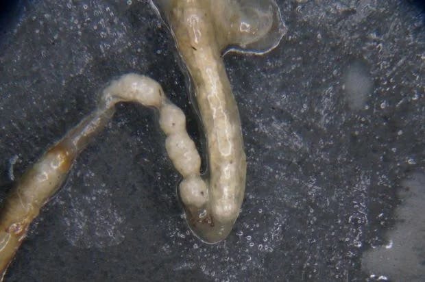 Du polystyrène dans l'intestin d'une larve de super vers. Photo : The University of Queensland.