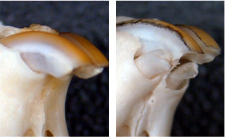 dents nouvelles USAG-1