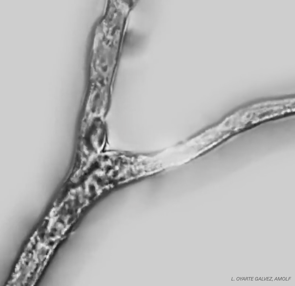 Structure cellulaire ramifiée observée au microscope, probablement un filament de champignon ou une hyphe.