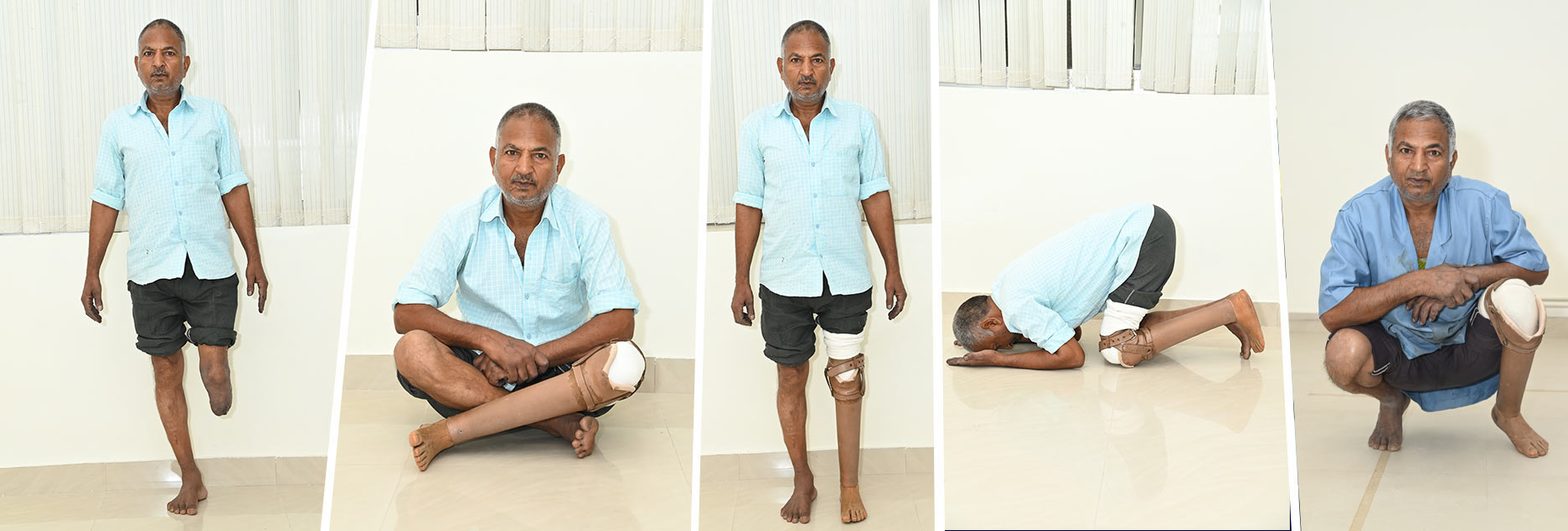 Un homme avec une prothèse de jambe, assis et debout, en trois photos.